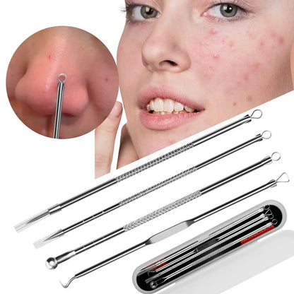 Clear Skin Pro Blackhead & Acne Remover Set